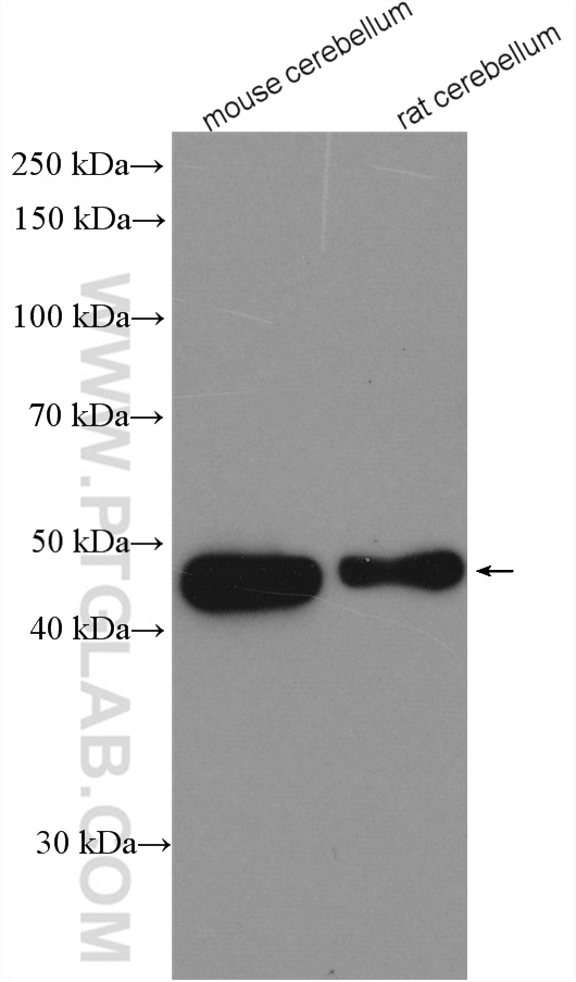 PAX2 Polyclonal antibody