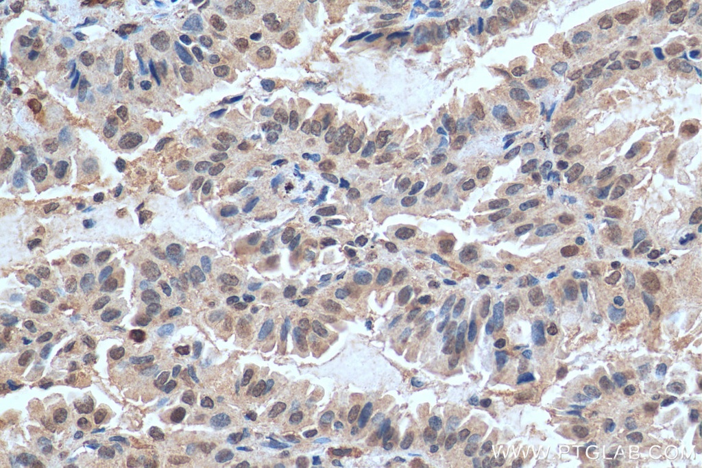 FAM111B Polyclonal antibody