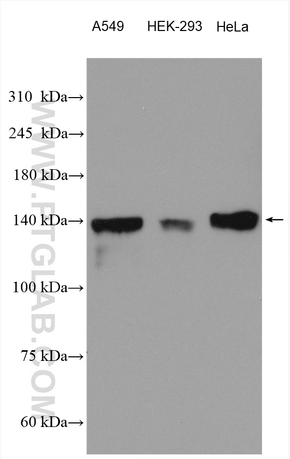 PTPRS Polyclonal antibody