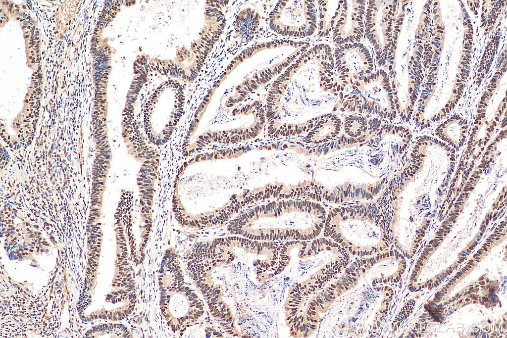 YTHDC1 Polyclonal antibody