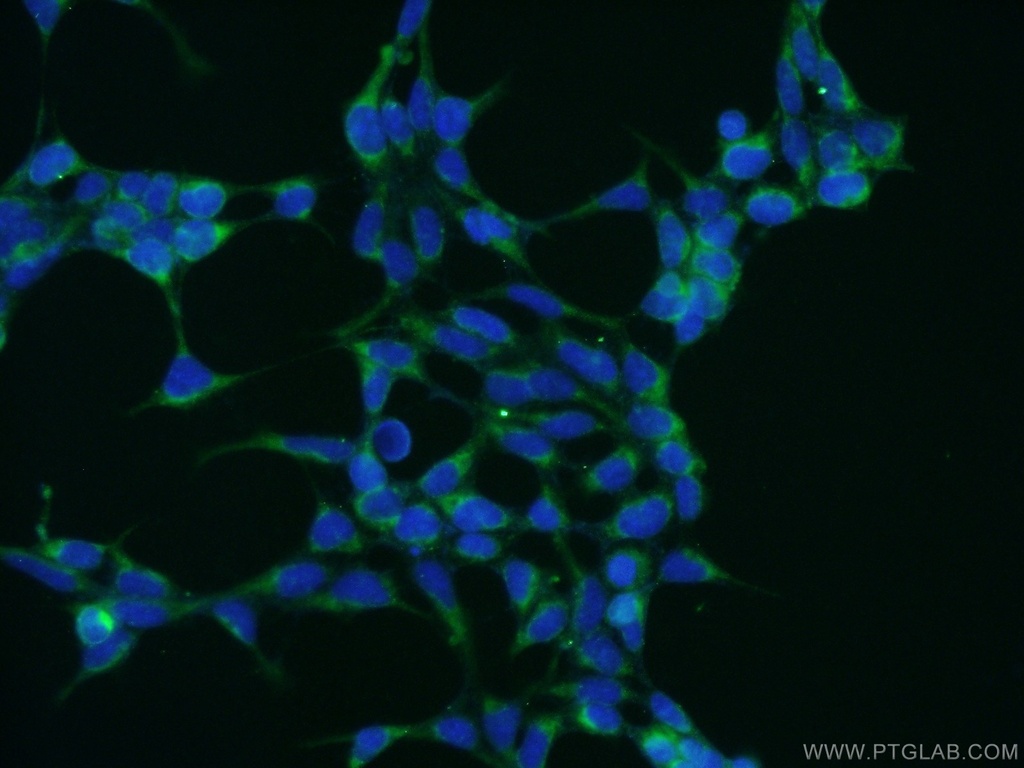 PTRH2 Polyclonal antibody