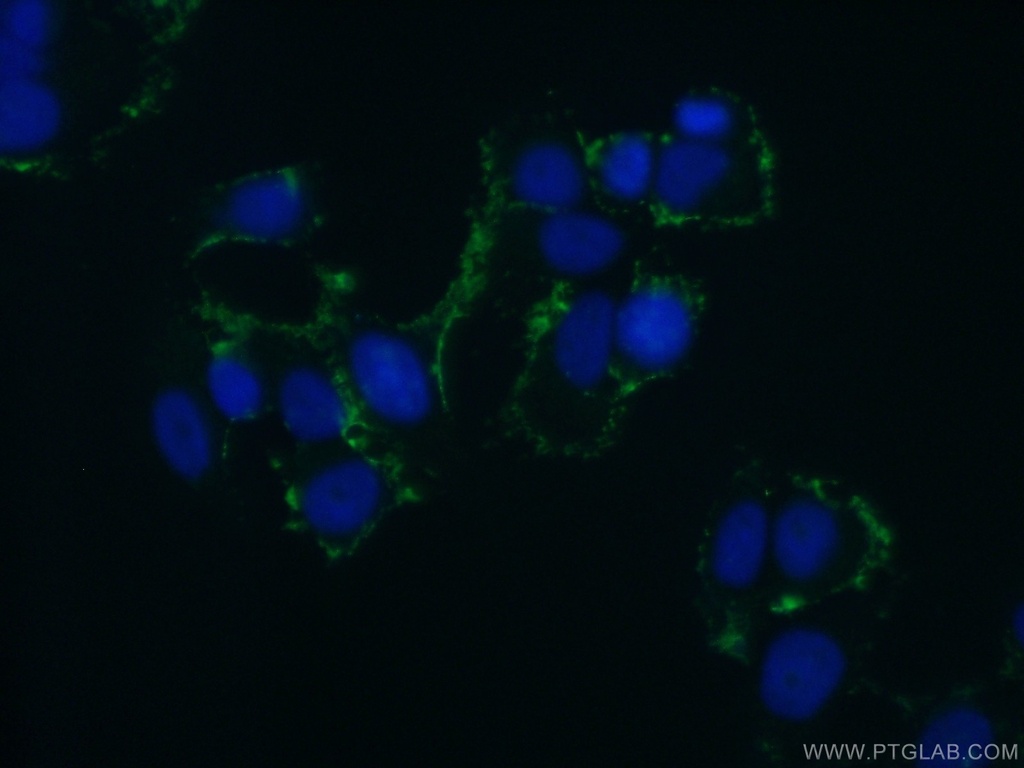ABCB6 Polyclonal antibody