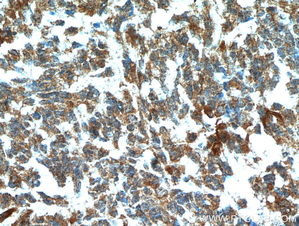 FABP7 Polyclonal antibody