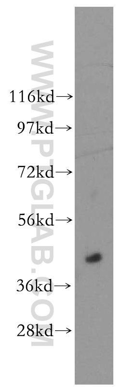 ACOT7L Polyclonal antibody