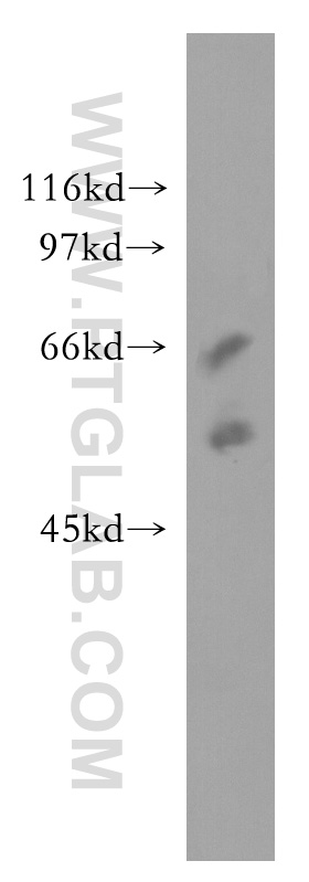 SSTR5 Polyclonal antibody