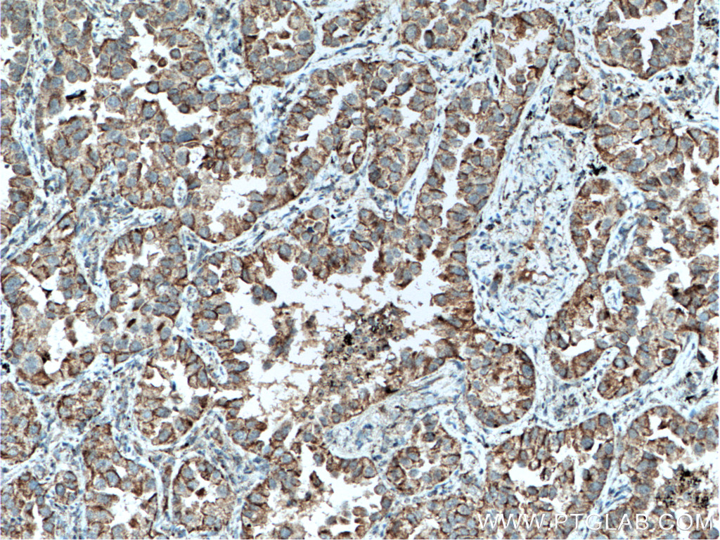 SLC25A6 Polyclonal antibody