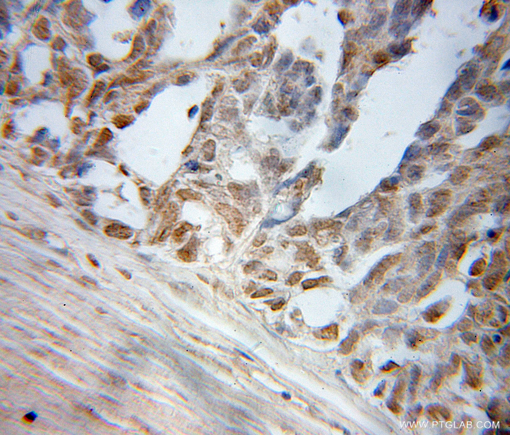 ELL Polyclonal antibody