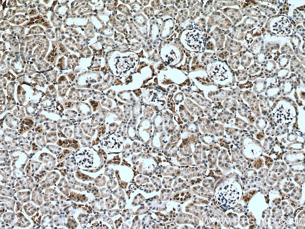 Myh9 Polyclonal antibody