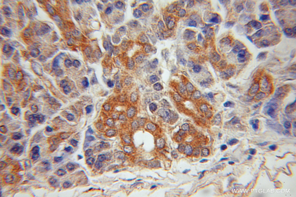 Jph2 Polyclonal antibody