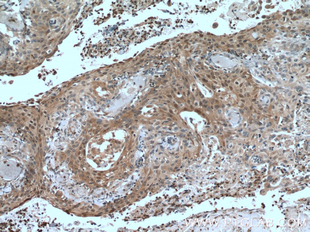 IkB Alpha Polyclonal antibody
