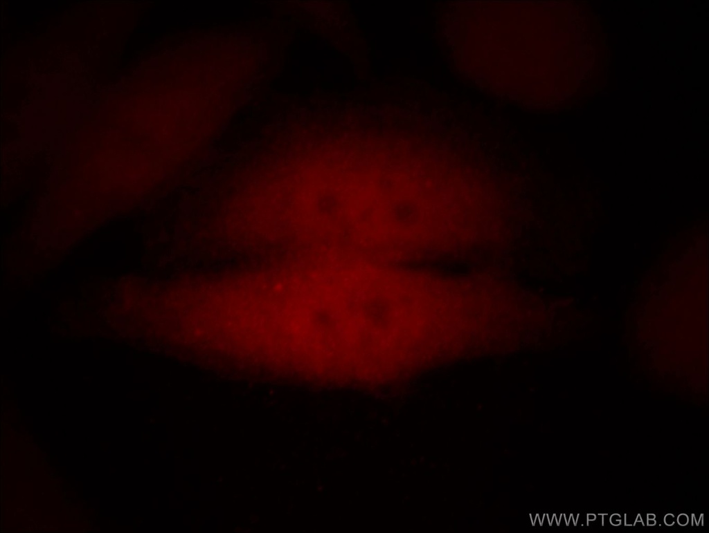 SMAD4 Polyclonal antibody