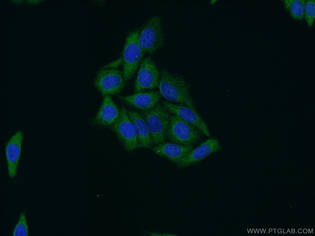 STAT4 Polyclonal antibody