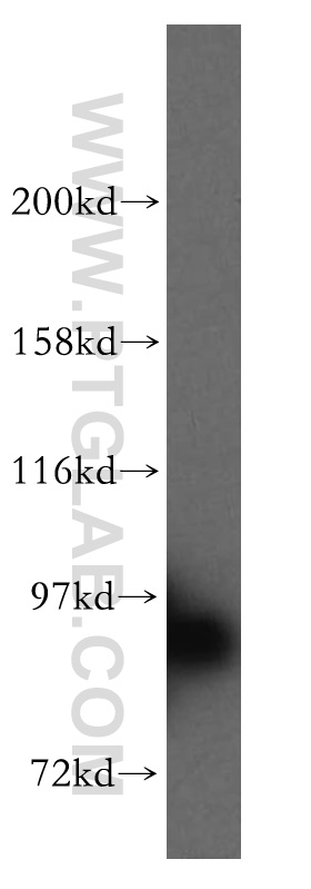 STAT5B Polyclonal antibody