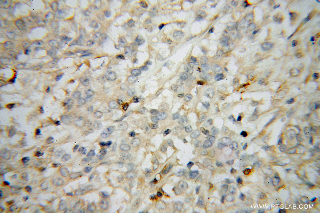 STAT2 Polyclonal antibody