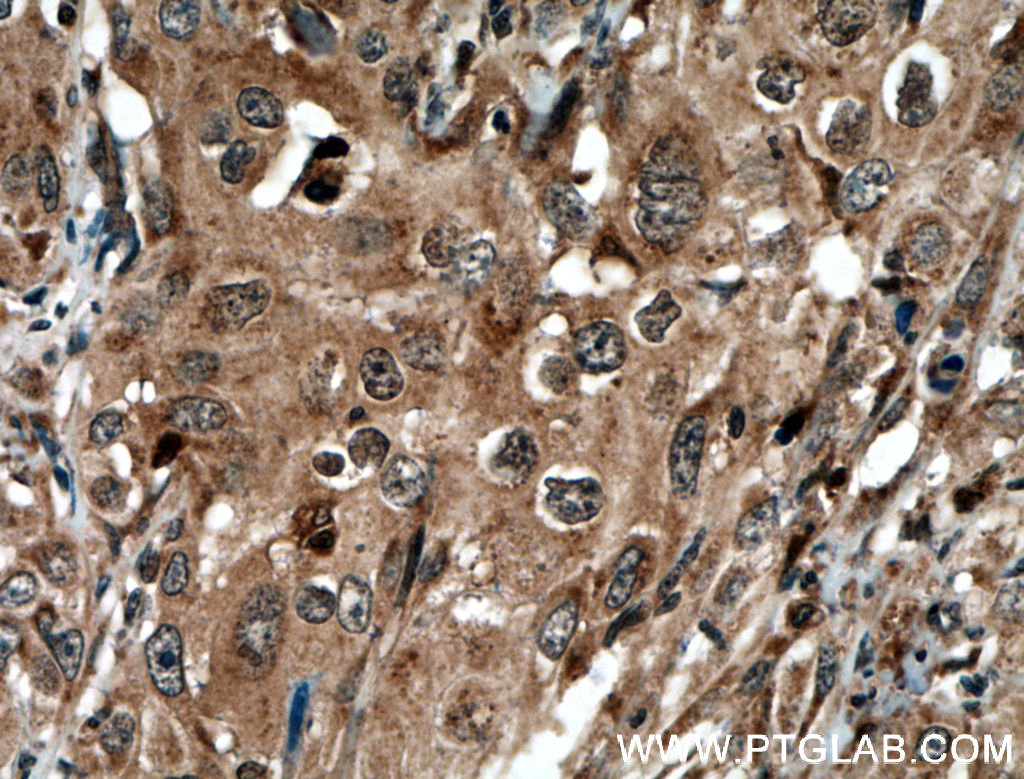 STAT3 Polyclonal antibody