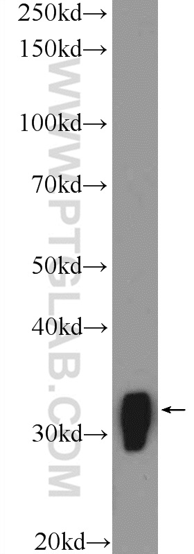 MARCKS Polyclonal antibody