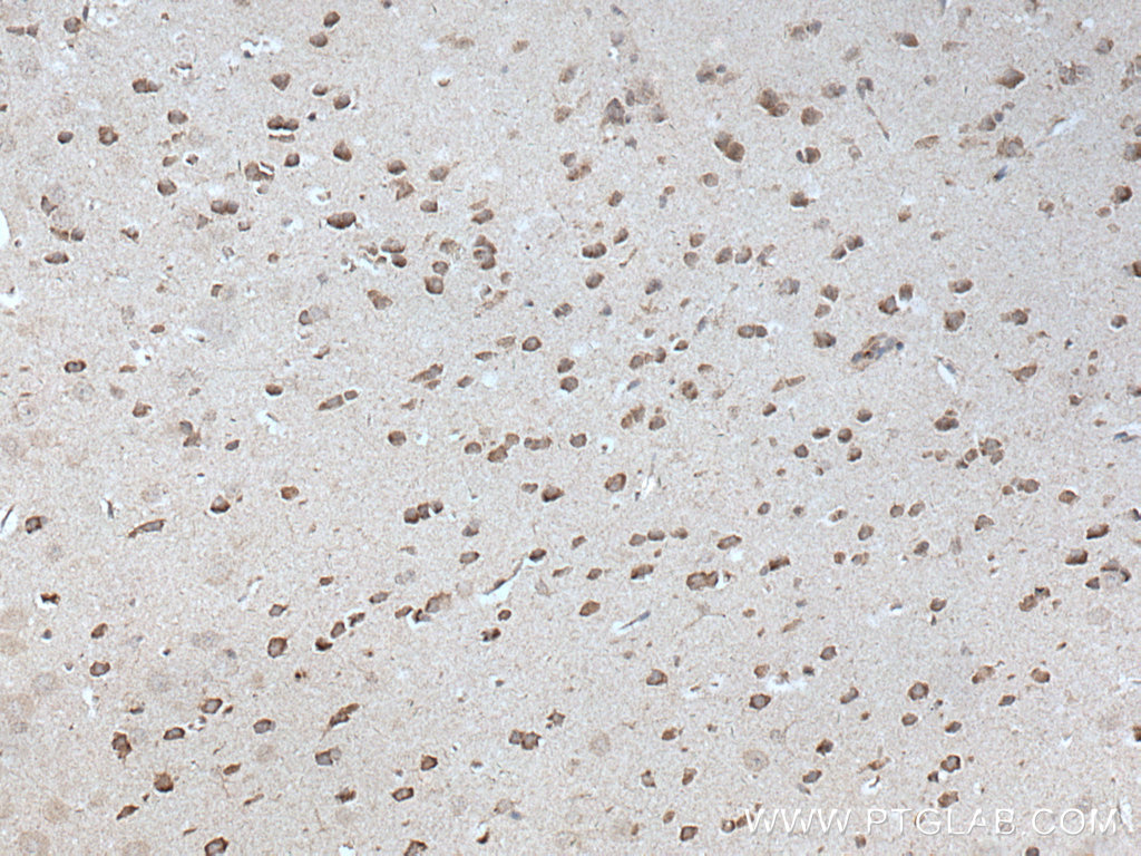 ADORA2A Polyclonal antibody