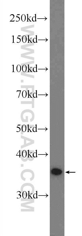 MEK6 Polyclonal antibody