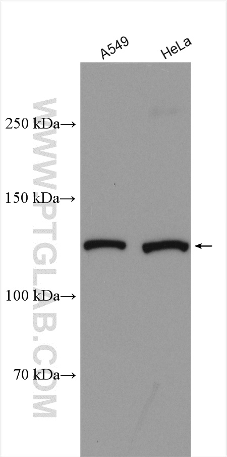 KIAA1033 Polyclonal antibody