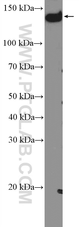 PLCB3 Polyclonal antibody