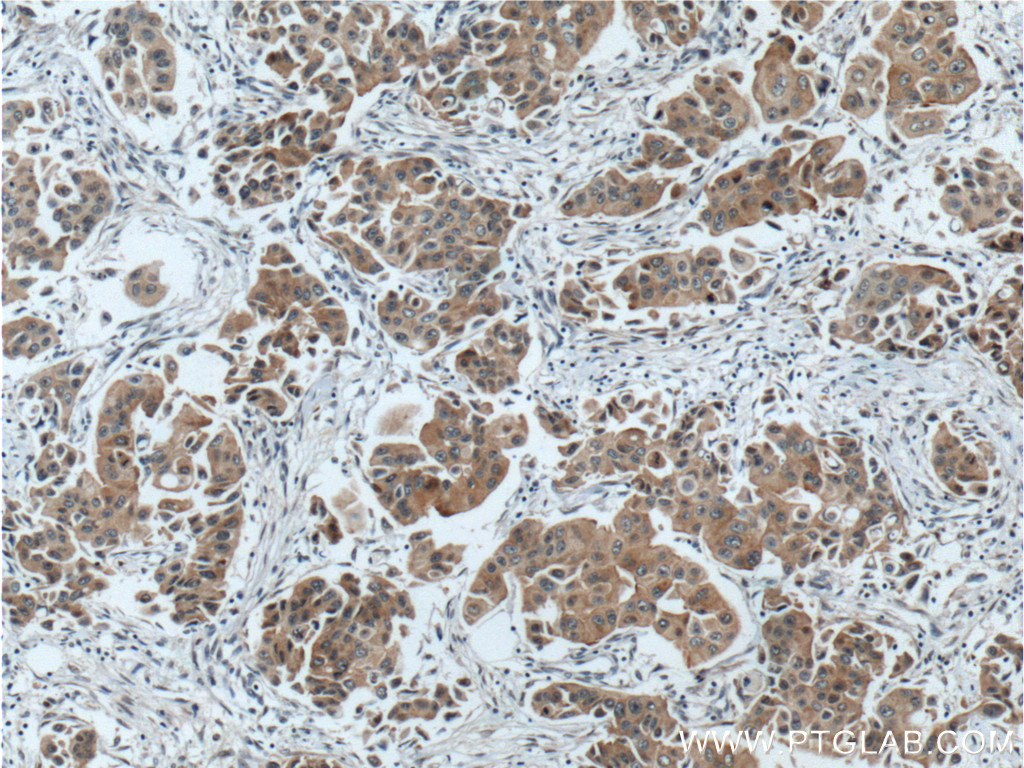 PPP1R13L Polyclonal antibody