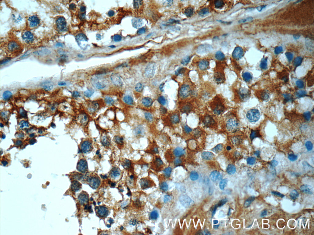 ATP6V1A Polyclonal antibody
