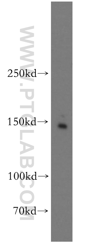 Drosha Polyclonal antibody