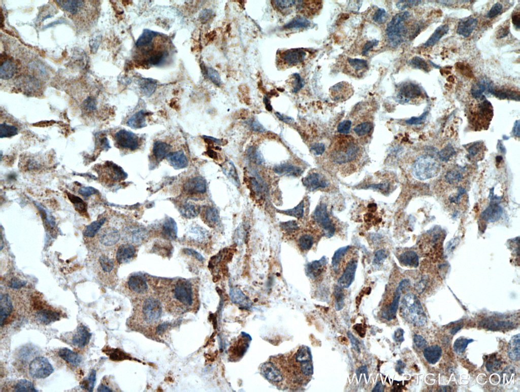 WDFY3 Polyclonal antibody
