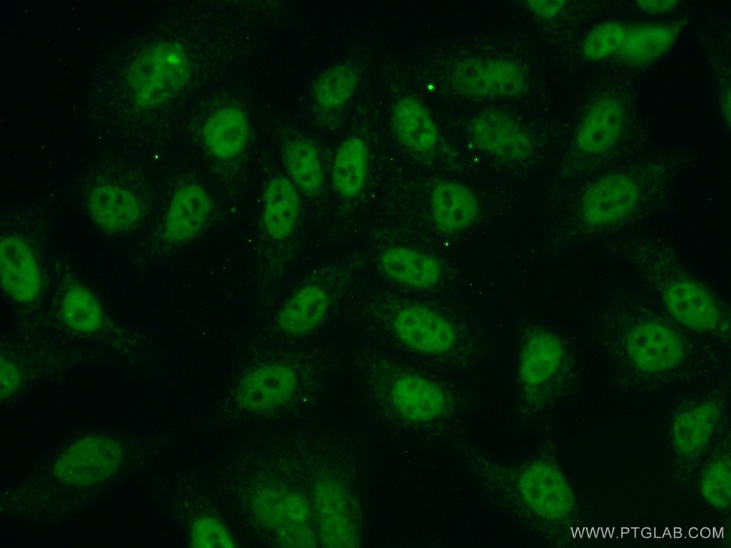NBS1 Polyclonal antibody