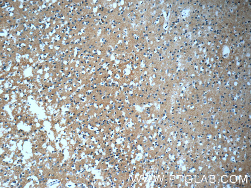 GFRA2 Polyclonal antibody