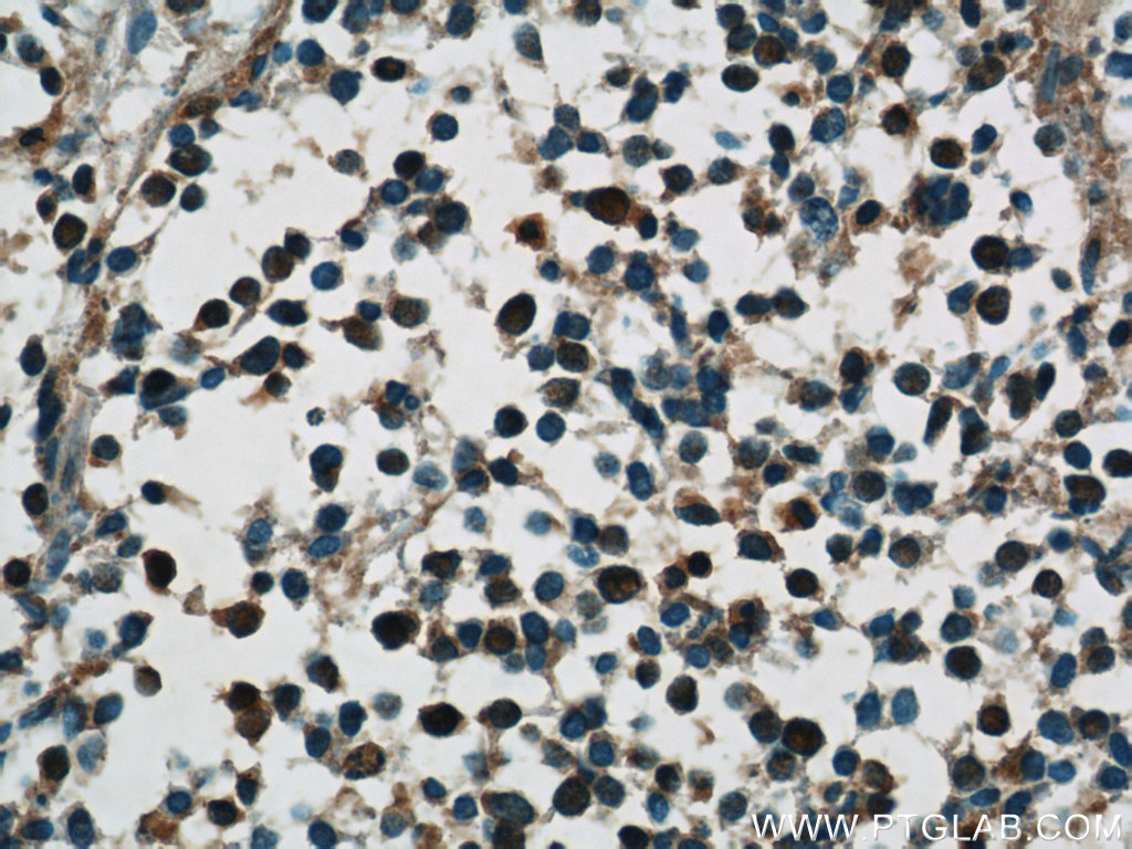 HuC Polyclonal antibody