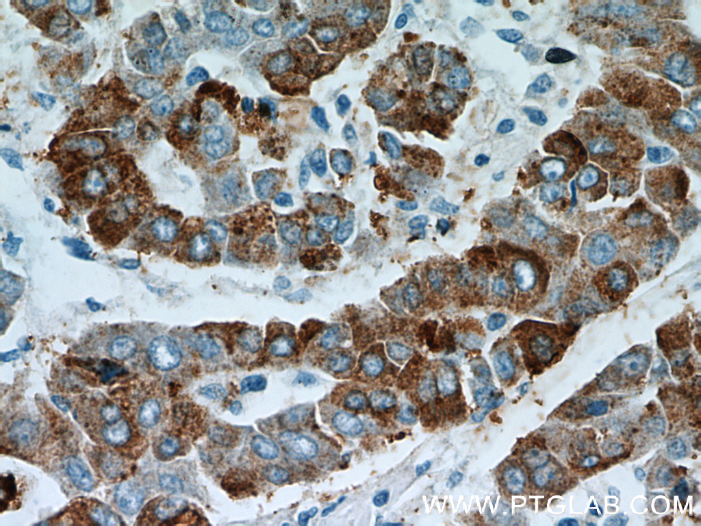 B3GALT6 Polyclonal antibody
