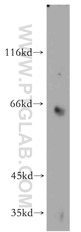 Toca 1 Polyclonal antibody
