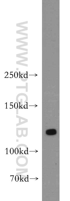 DLGAP3 Polyclonal antibody