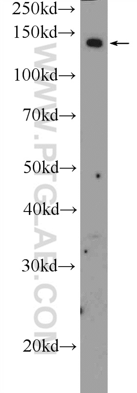 ADCY8 Polyclonal antibody