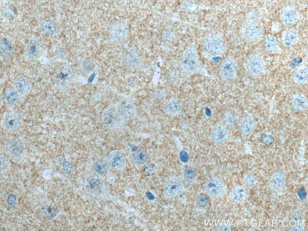 ADCY1 Polyclonal antibody