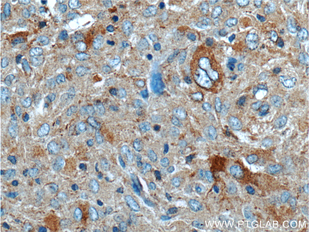PLA2G4B Polyclonal antibody