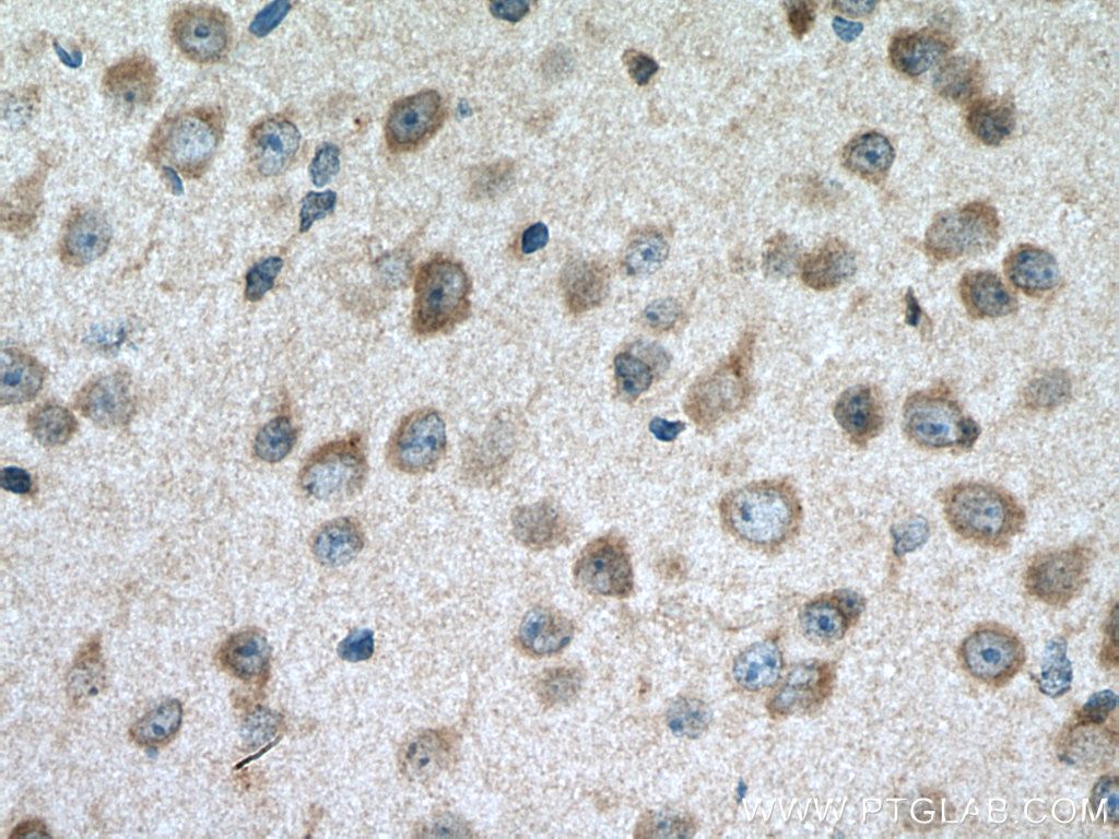 CACNG8 Polyclonal antibody