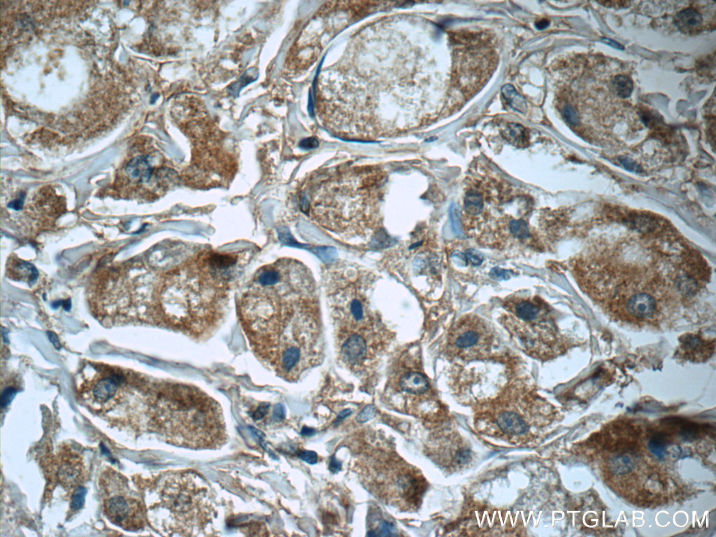 PRDX3 Polyclonal antibody