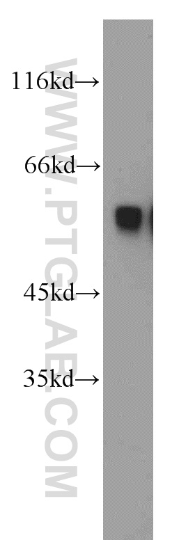 PKMYT1 Polyclonal antibody