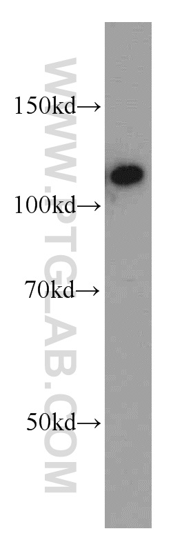 CIITA Polyclonal antibody
