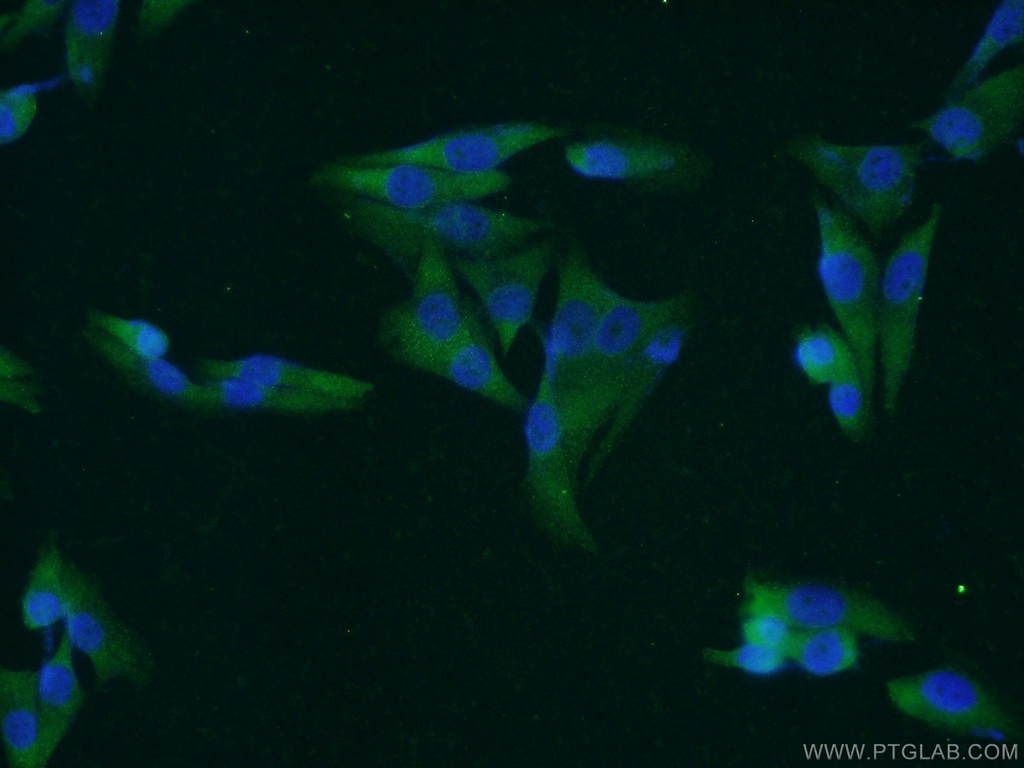 MAGEA1 Polyclonal antibody
