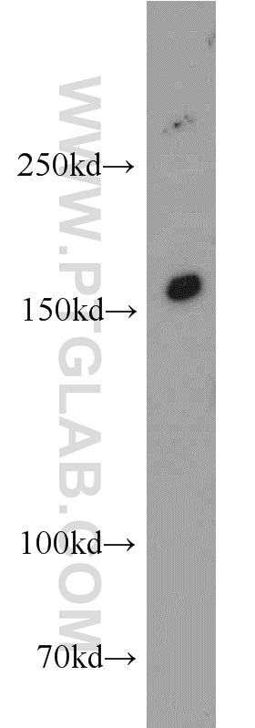 INSRR Polyclonal antibody