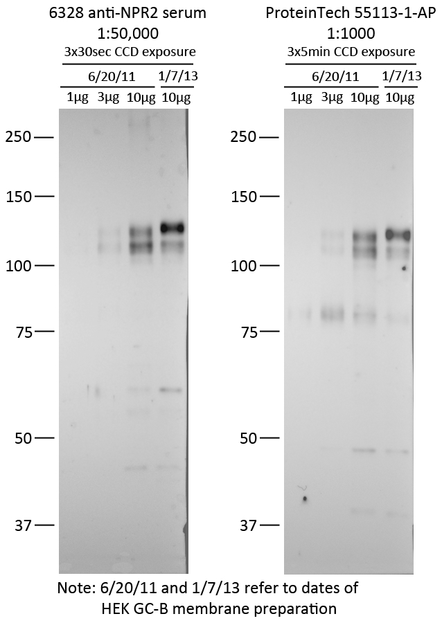 NPR2 Polyclonal antibody