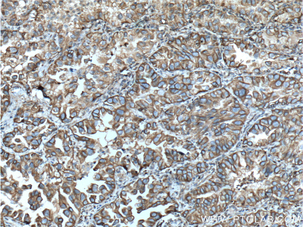 NOTCH3 Polyclonal antibody
