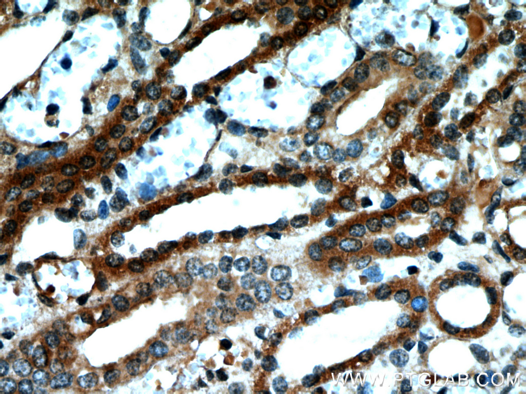 NUDT19 Polyclonal antibody
