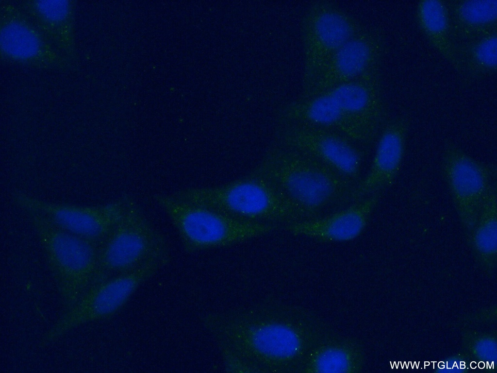 PSAPL1 Polyclonal antibody