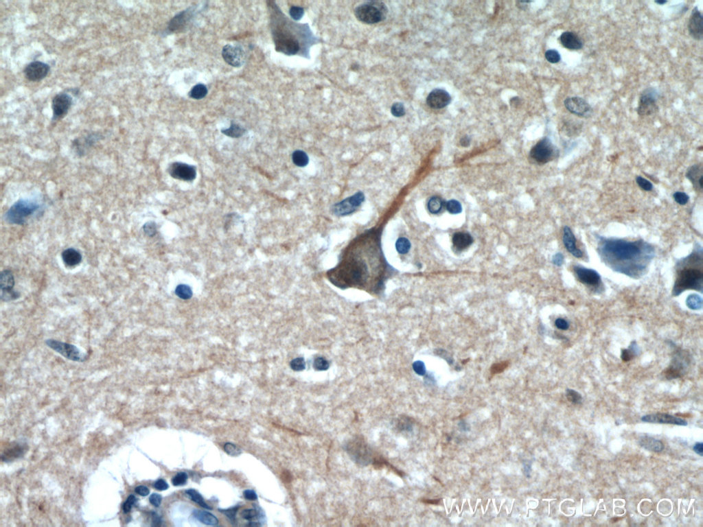PPP1R9B Polyclonal antibody