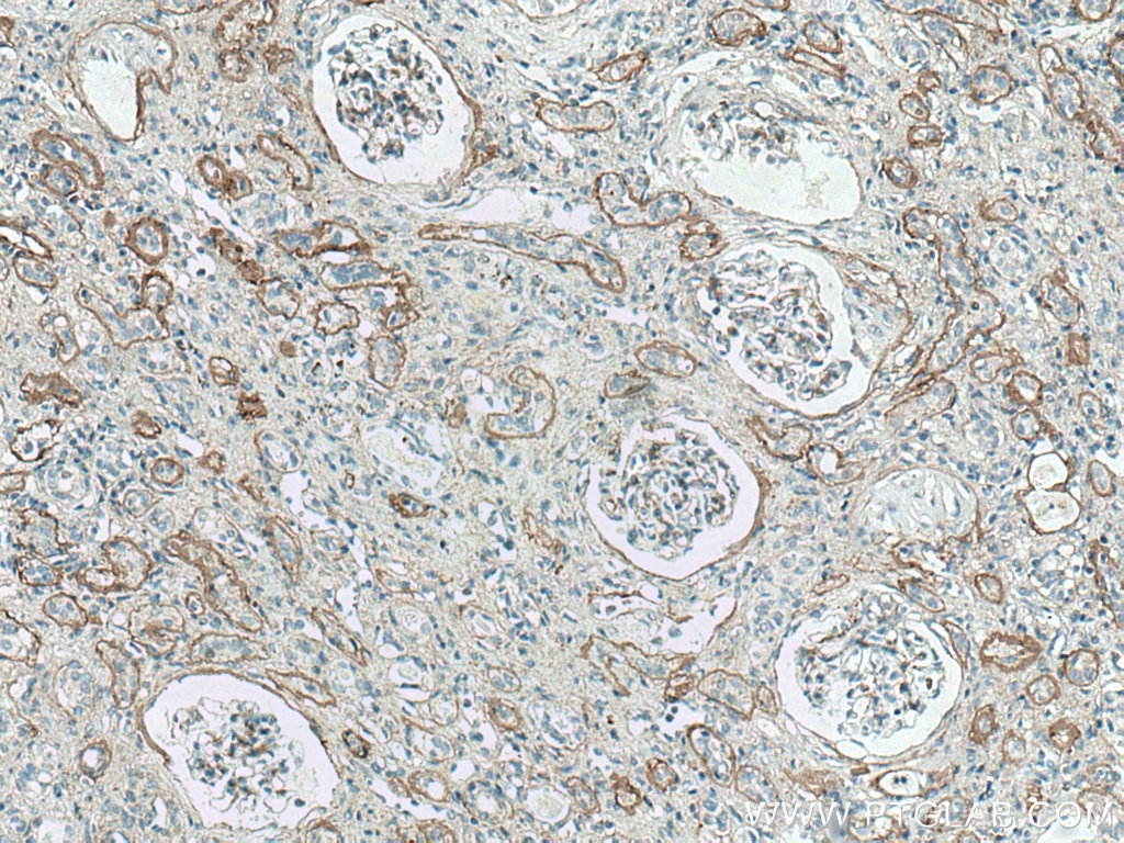 Collagen Type IV Polyclonal antibody