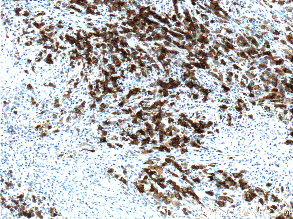 CD30 Polyclonal antibody